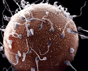 sperm testi sonolab